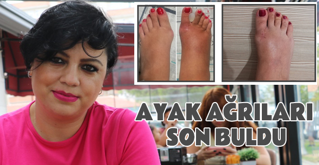 Anadolu Hastanesinde Ayak Ağrılarına Son Buldu