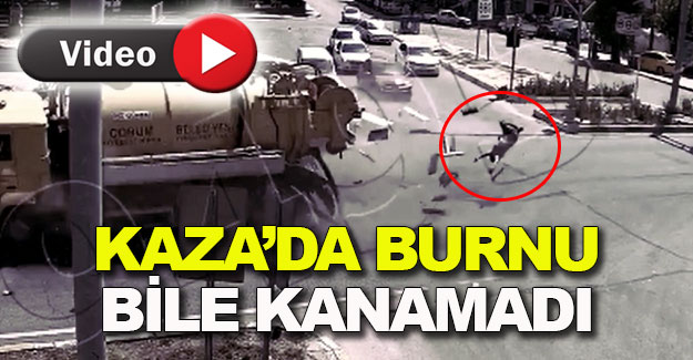 Kaza'da burnu bile kanamadı